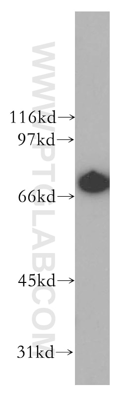 Western Blot (WB) analysis of Jurkat cells using LTA4H Polyclonal antibody (13662-1-AP)