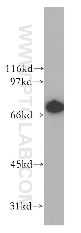WB analysis of Jurkat using 13662-1-AP