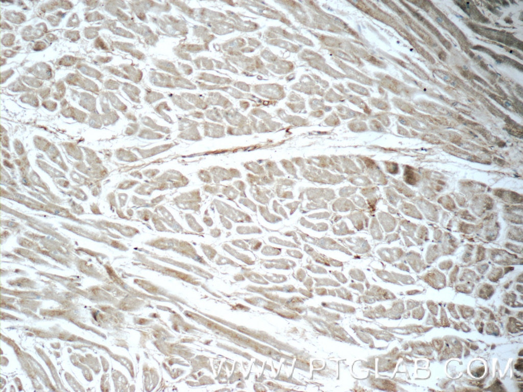 Immunohistochemistry (IHC) staining of human heart tissue using LTB4R Polyclonal antibody (55137-1-AP)