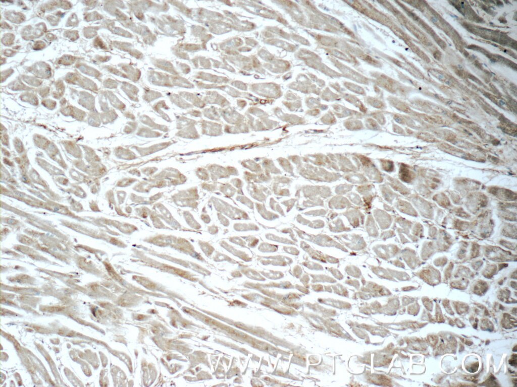 Immunohistochemistry (IHC) staining of human heart tissue using LTB4R Polyclonal antibody (55137-1-AP)