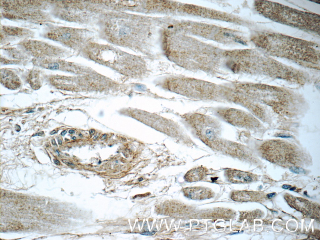 Immunohistochemistry (IHC) staining of human heart tissue using LTB4R Polyclonal antibody (55137-1-AP)