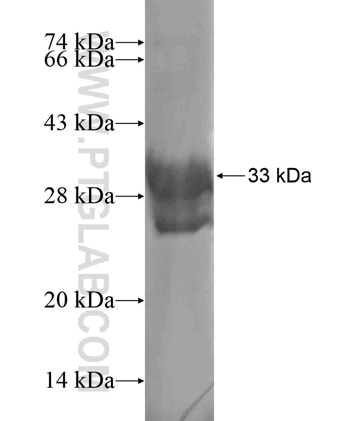 LTB4R fusion protein Ag17558 SDS-PAGE