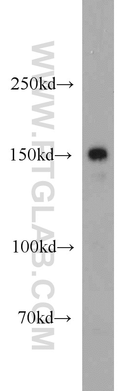 Western Blot (WB) analysis of mouse liver tissue using LTBP1 Polyclonal antibody (22065-1-AP)