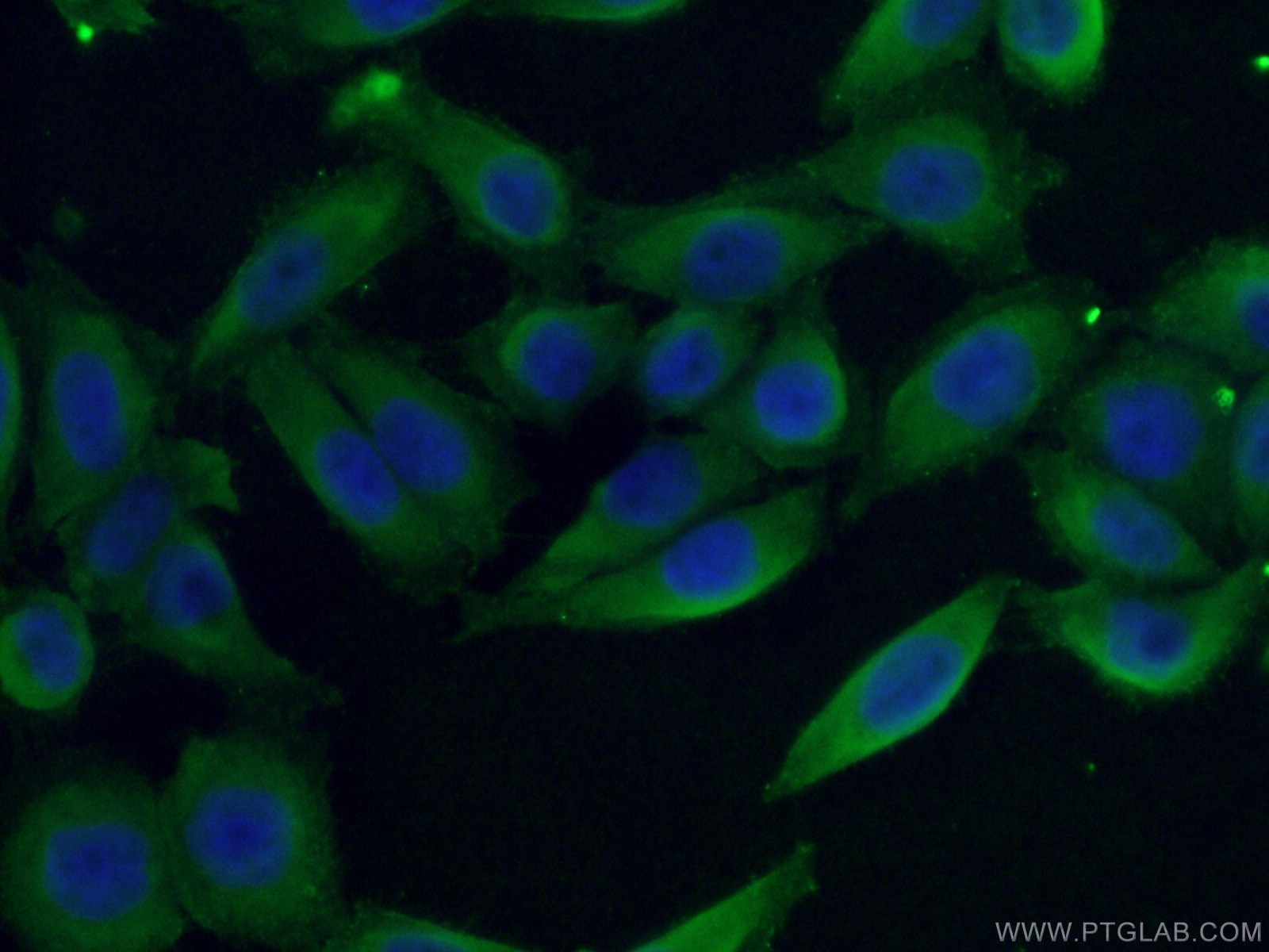 Immunofluorescence (IF) / fluorescent staining of HeLa cells using LTBP1 Polyclonal antibody (26855-1-AP)