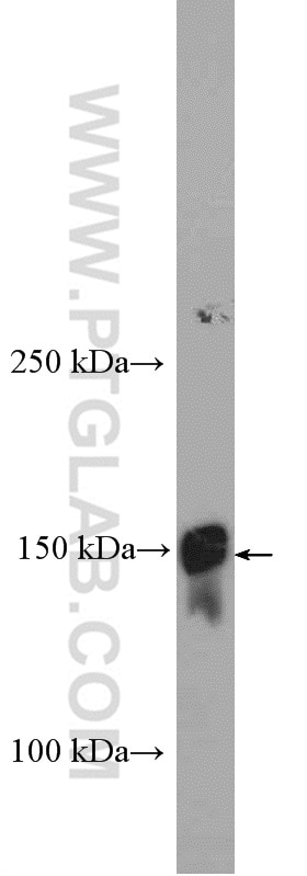 Western Blot (WB) analysis of human plasma using LTBP1 Polyclonal antibody (26855-1-AP)