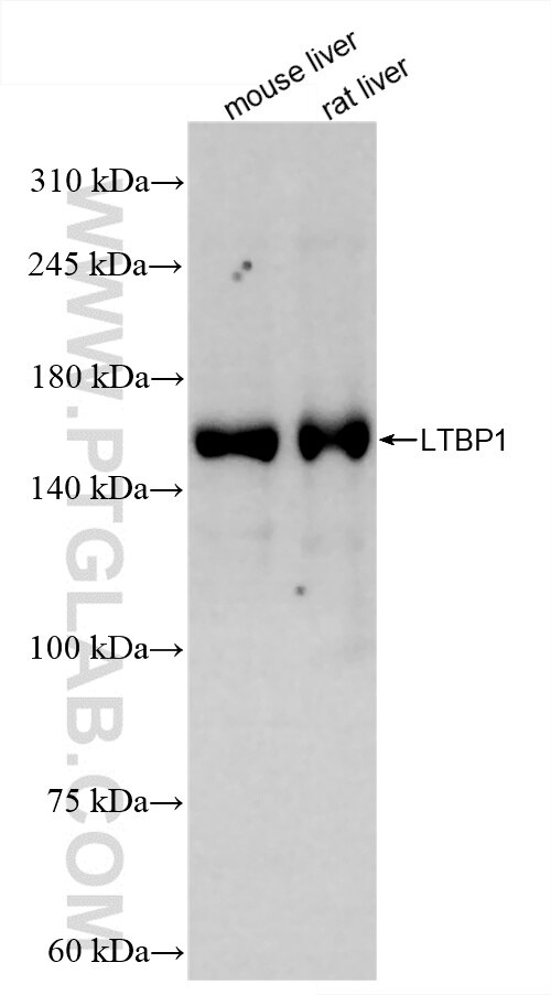 Western Blot (WB) analysis of various lysates using LTBP1 Recombinant antibody (85820-1-RR)