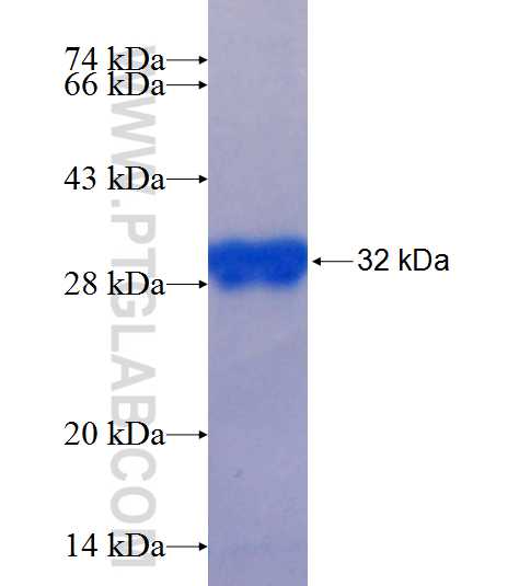 LTBP1 fusion protein Ag25392 SDS-PAGE