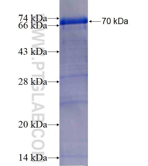 LTBP1 fusion protein Ag17141 SDS-PAGE