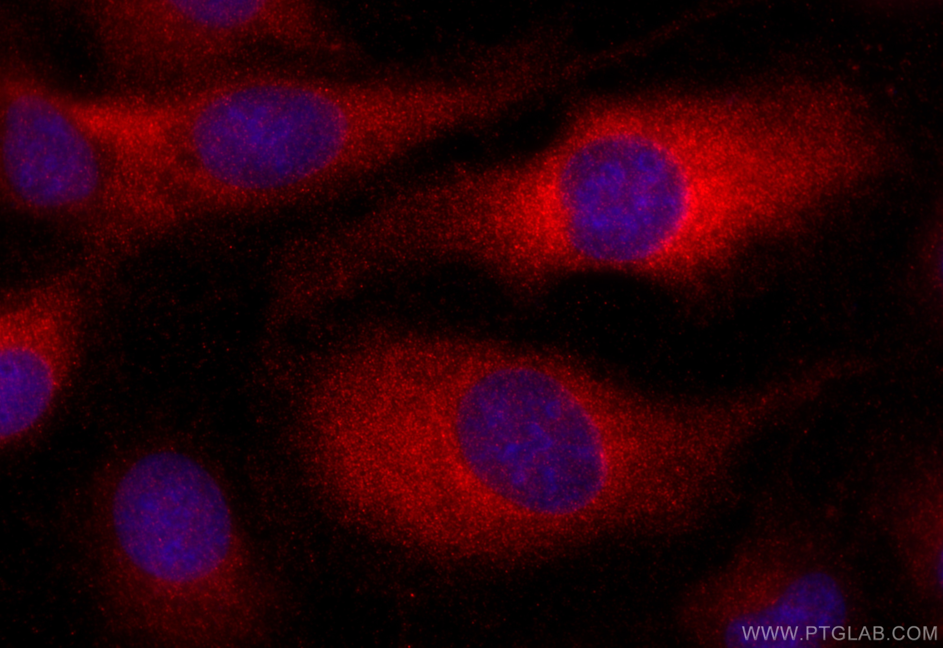 Immunofluorescence (IF) / fluorescent staining of U2OS cells using LTBP2 Polyclonal antibody (28824-1-AP)