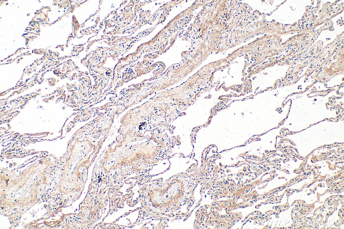 Immunohistochemistry (IHC) staining of human lung tissue using LTBP2 Polyclonal antibody (28824-1-AP)