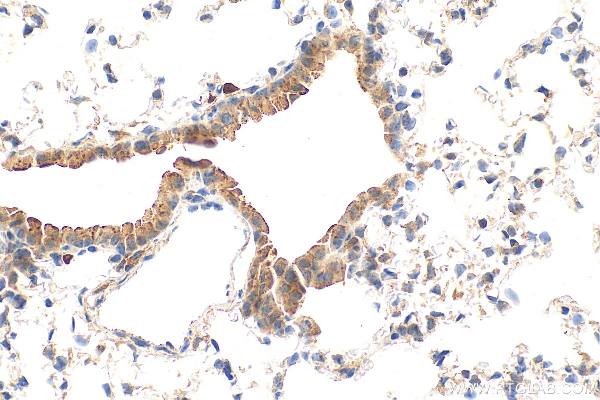 Immunohistochemistry (IHC) staining of mouse lung tissue using LTBP2 Polyclonal antibody (28824-1-AP)