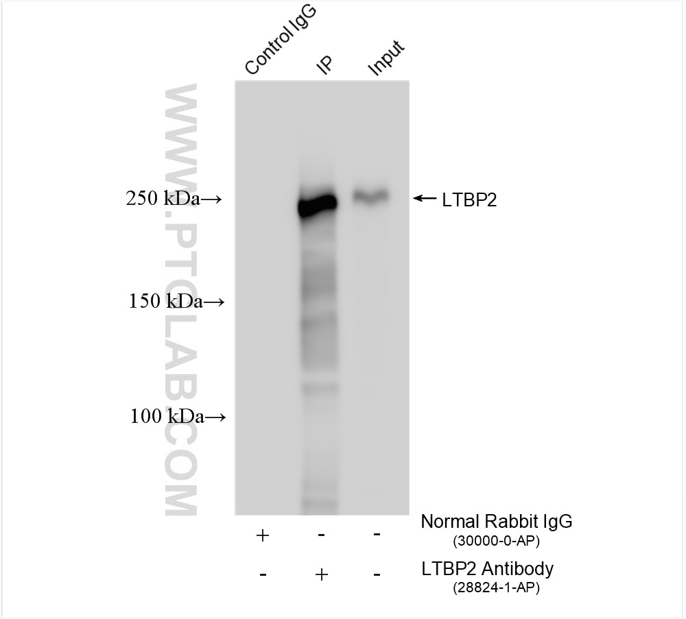 Immunoprecipitation (IP) experiment of U2OS cells using LTBP2 Polyclonal antibody (28824-1-AP)