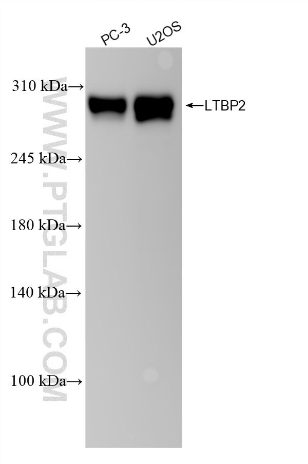 LTBP2