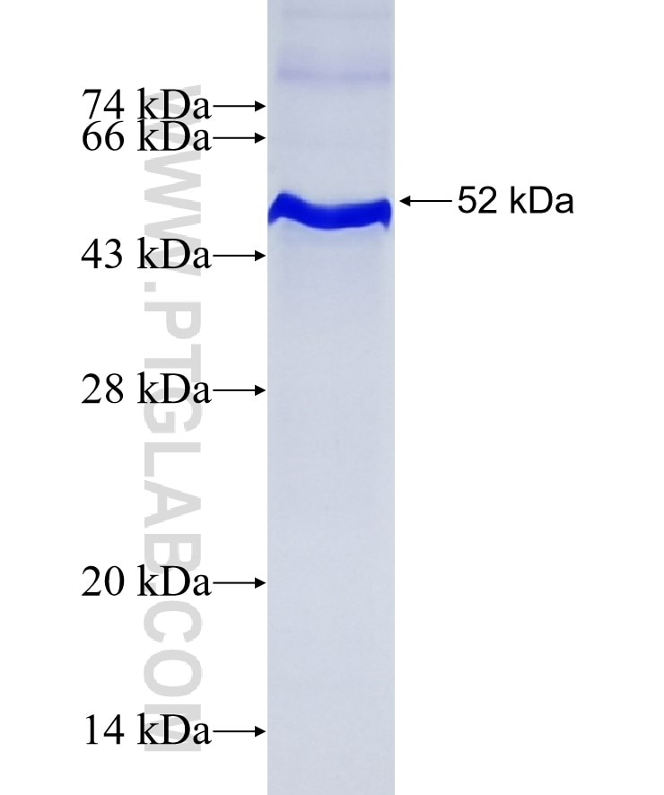 LTBP2 fusion protein Ag12718 SDS-PAGE