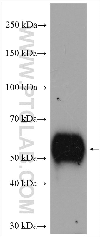 Western Blot (WB) analysis of HeLa cells using LTBR Polyclonal antibody (20331-1-AP)