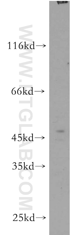 WB analysis of mouse brain using 20331-1-AP