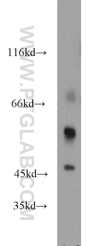 Western Blot (WB) analysis of mouse brain tissue using LTBR Polyclonal antibody (20331-1-AP)