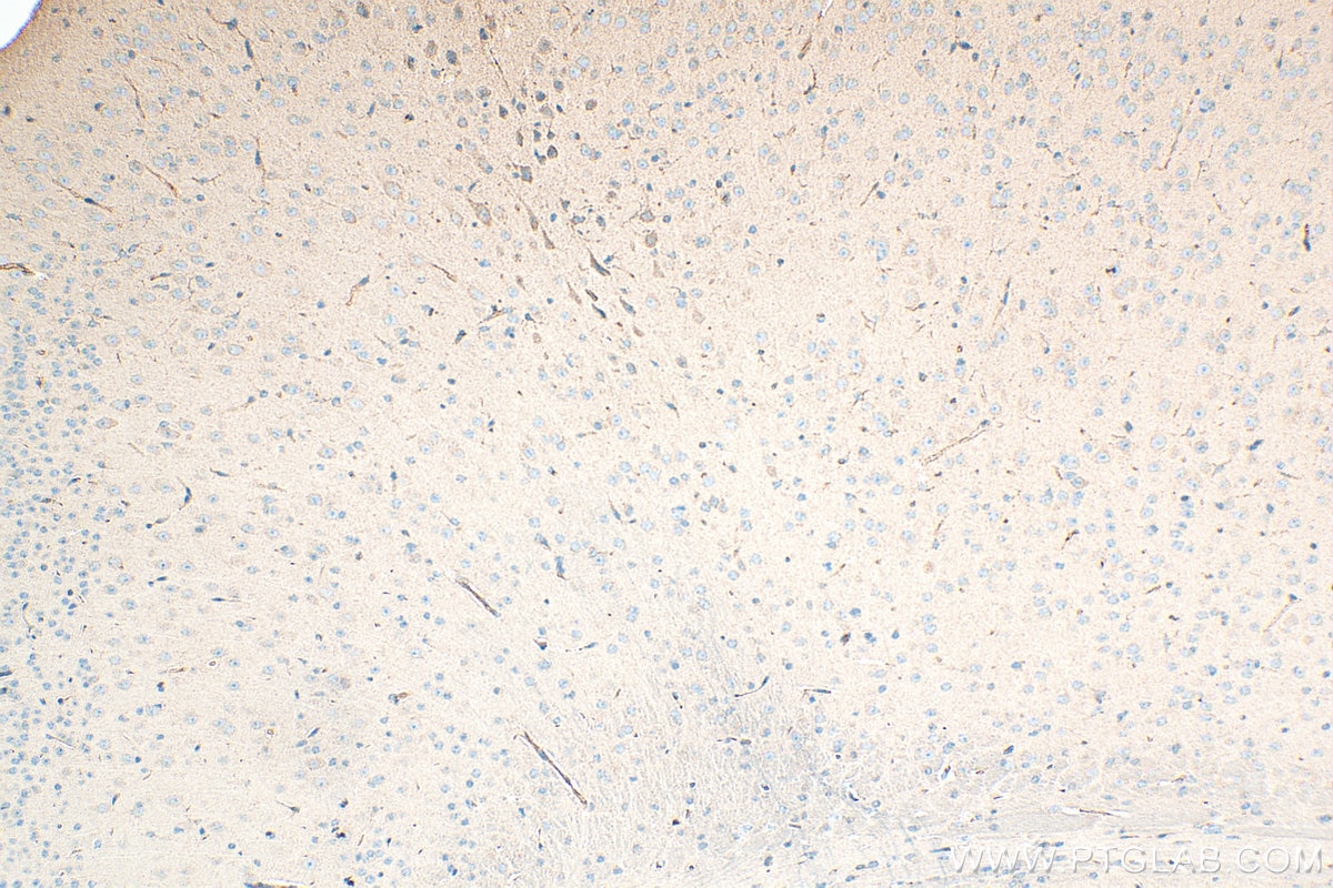 Immunohistochemistry (IHC) staining of mouse brain tissue using Lactotransferrin/LTF Polyclonal antibody (10933-1-AP)
