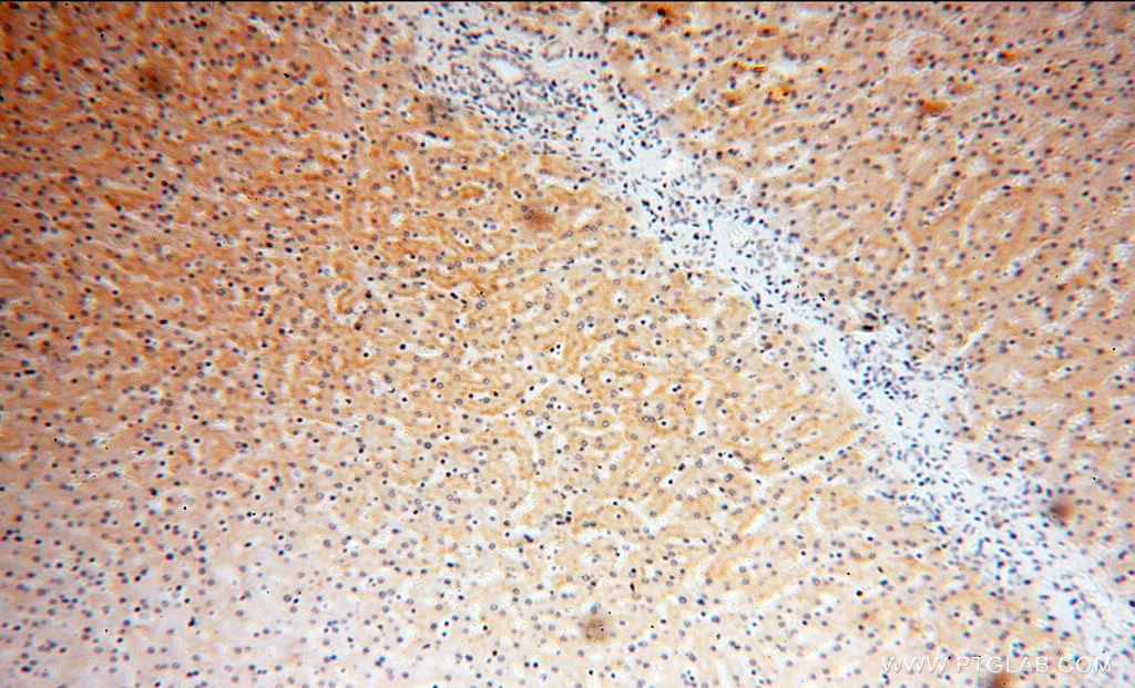 Immunohistochemistry (IHC) staining of human liver tissue using LTF Polyclonal antibody (10933-1-AP)