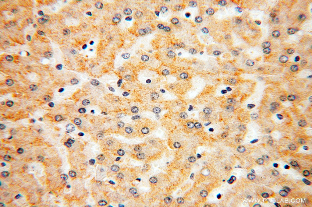 Immunohistochemistry (IHC) staining of human liver tissue using LTF Polyclonal antibody (10933-1-AP)