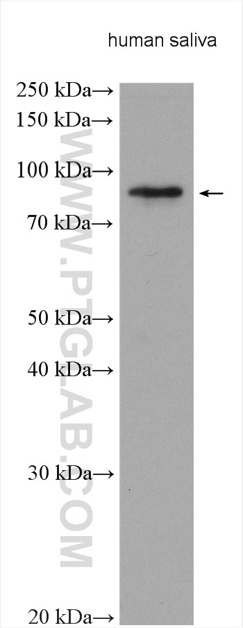 Western Blot (WB) analysis of various lysates using LTF Polyclonal antibody (10933-1-AP)