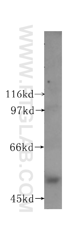 Western Blot (WB) analysis of HEK-293 cells using LTF Polyclonal antibody (10933-1-AP)