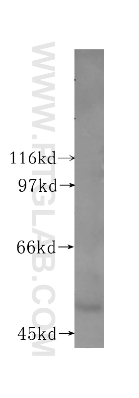 Western Blot (WB) analysis of human pancreas tissue using LTF Polyclonal antibody (10933-1-AP)