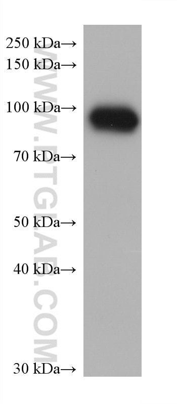 WB analysis of human saliva using 68509-1-Ig