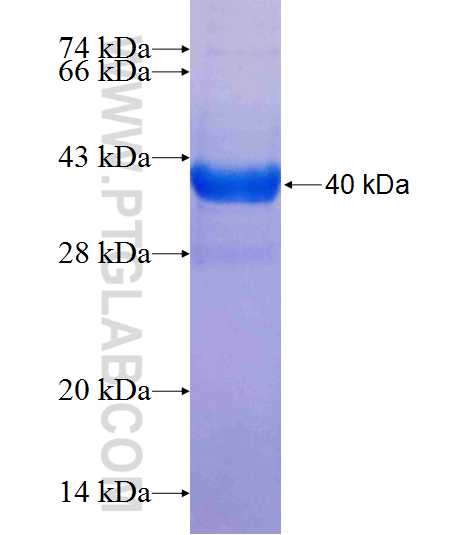LTV1 fusion protein Ag24992 SDS-PAGE