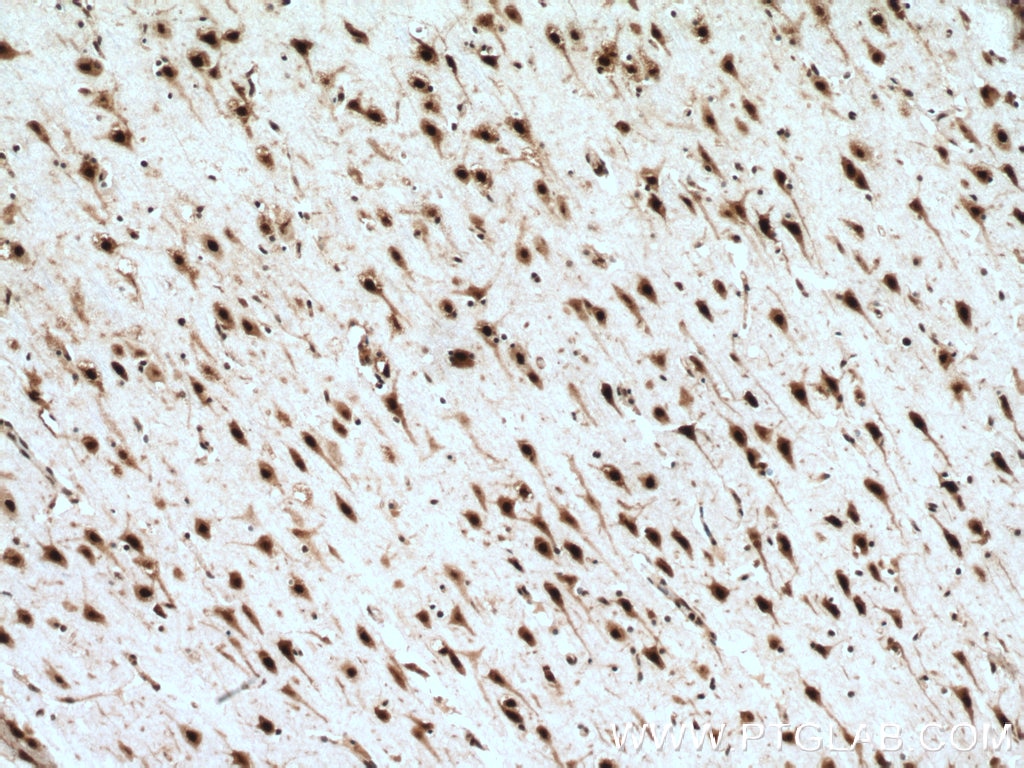 Immunohistochemistry (IHC) staining of human brain tissue using LUC7L Polyclonal antibody (17085-1-AP)