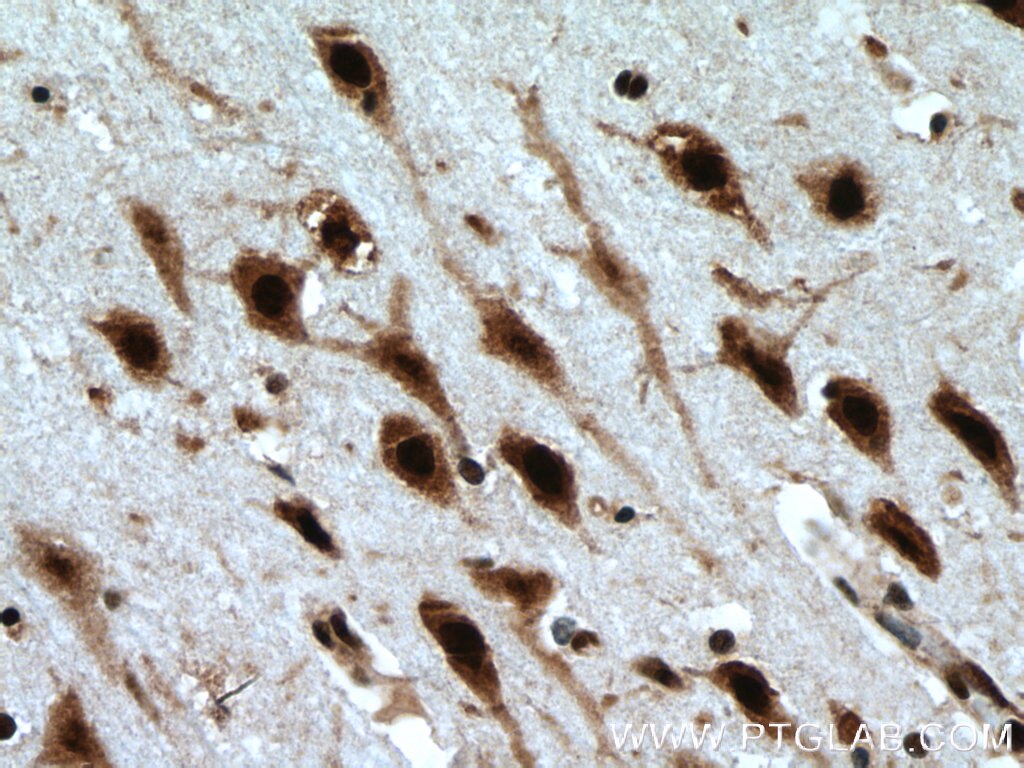 Immunohistochemistry (IHC) staining of human brain tissue using LUC7L Polyclonal antibody (17085-1-AP)