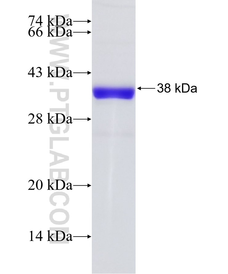 LUC7L fusion protein Ag9170 SDS-PAGE