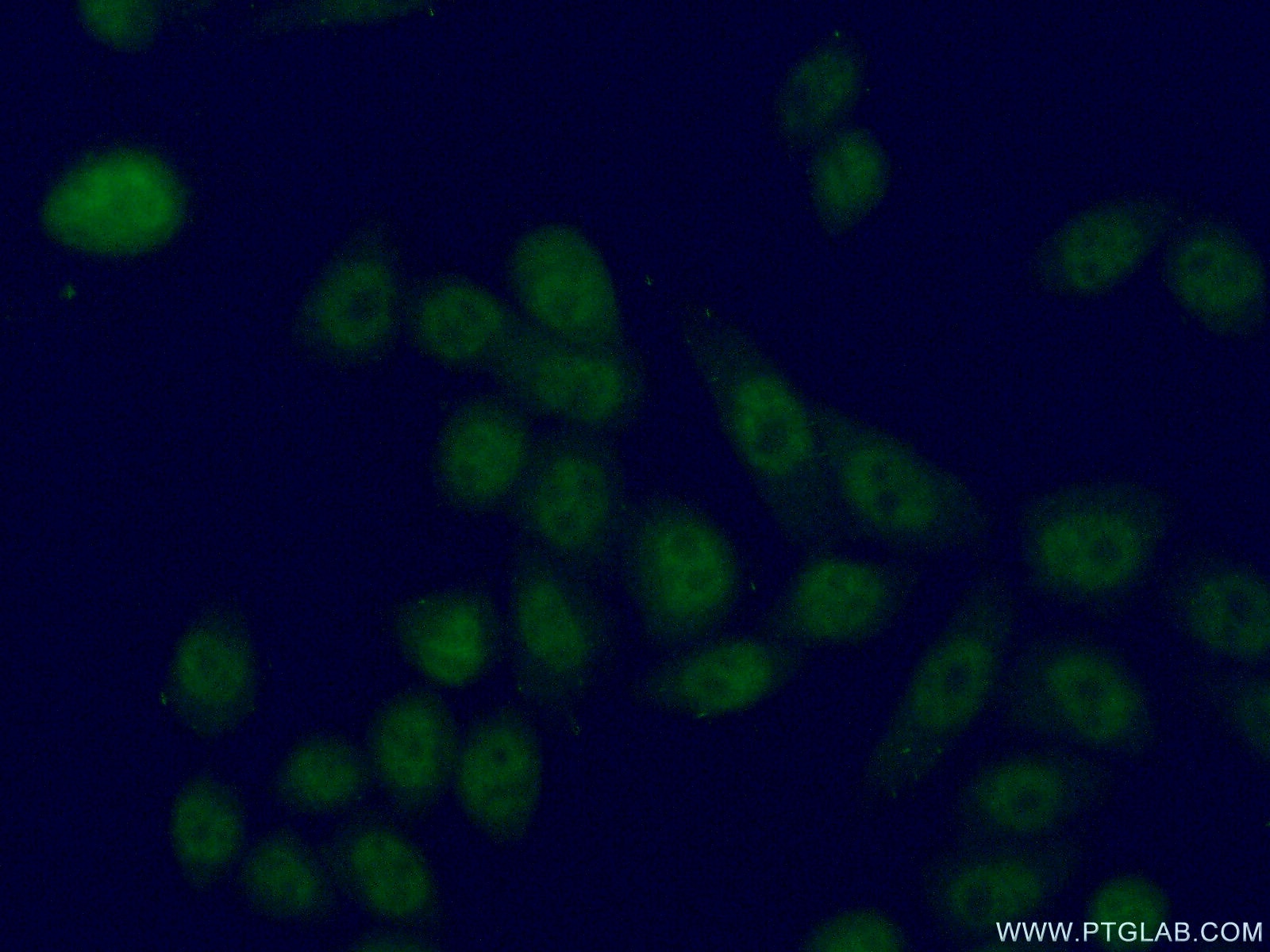 Immunofluorescence (IF) / fluorescent staining of HeLa cells using LUC7L2 Polyclonal antibody (24202-1-AP)