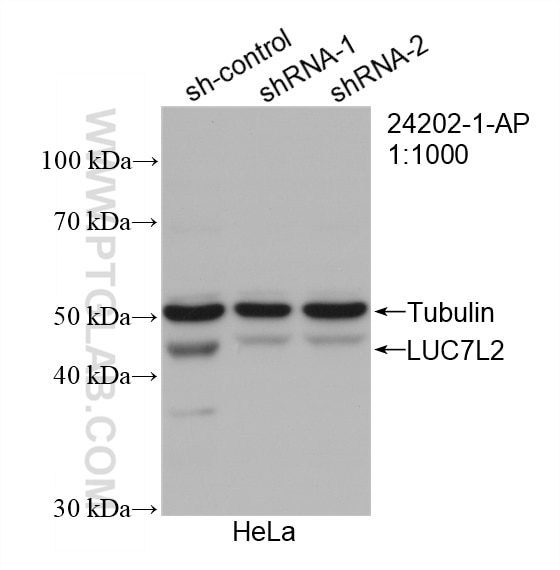 WB analysis of HeLa using 24202-1-AP