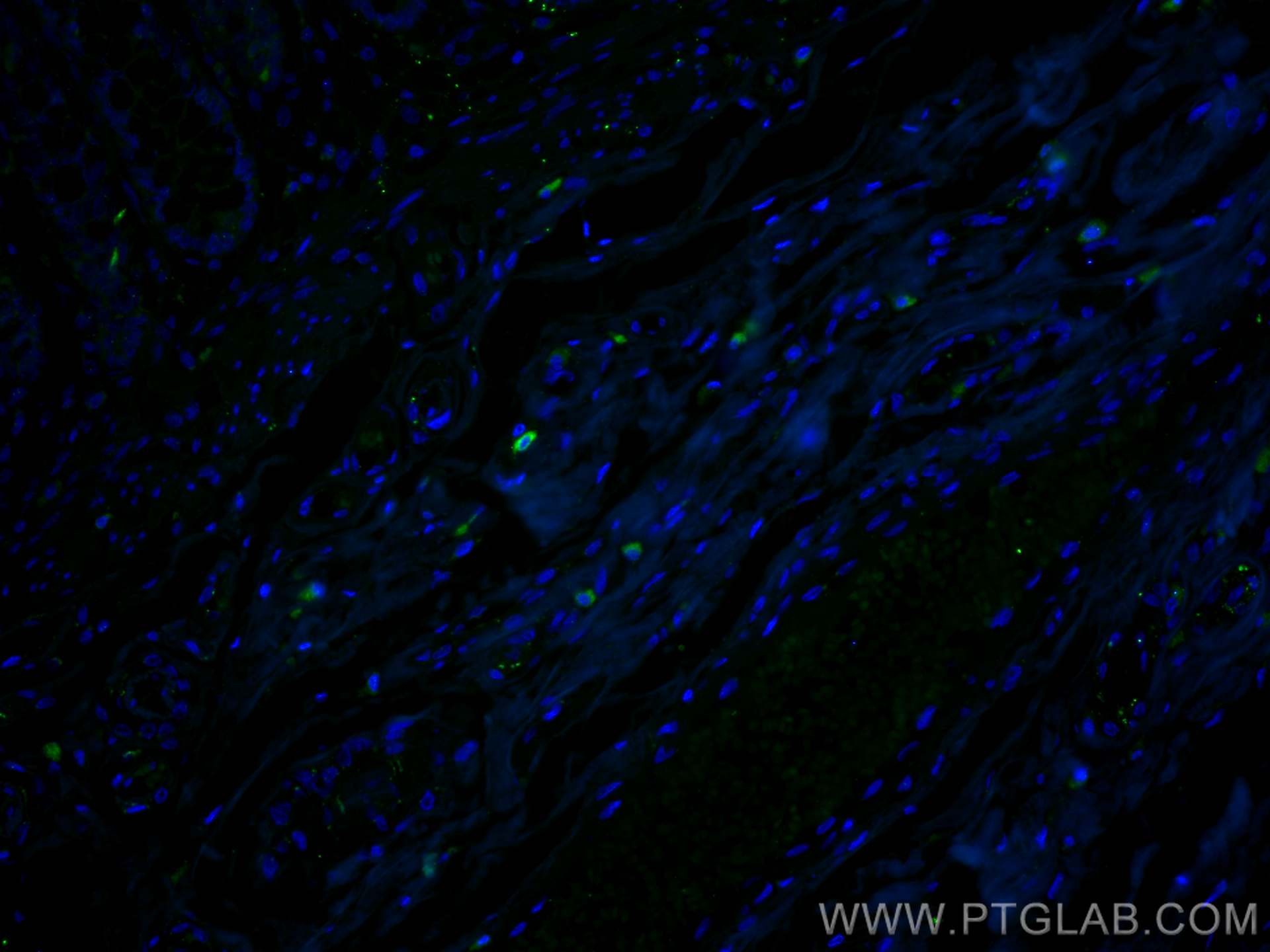 Immunofluorescence (IF) / fluorescent staining of human colon tissue using Lumican Polyclonal antibody (10677-1-AP)