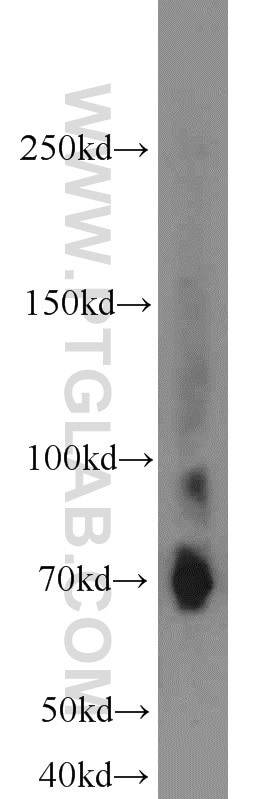 Western Blot (WB) analysis of Jurkat cells using Lumican Polyclonal antibody (10677-1-AP)