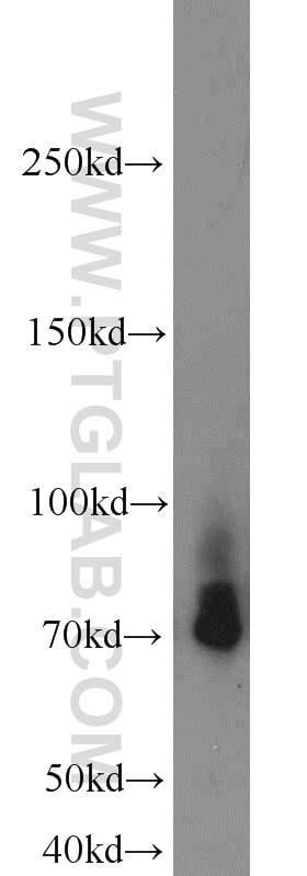 Western Blot (WB) analysis of Jurkat cells using Lumican Polyclonal antibody (10677-1-AP)