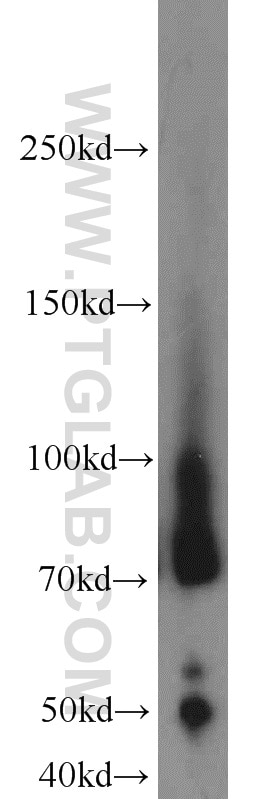 Western Blot (WB) analysis of Jurkat cells using Lumican Polyclonal antibody (10677-1-AP)