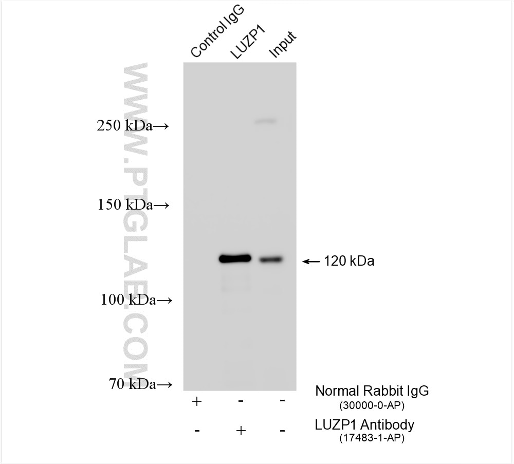 Immunoprecipitation (IP) experiment of mouse brain tissue using LUZP1 Polyclonal antibody (17483-1-AP)