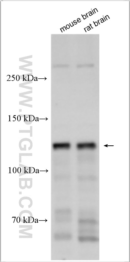 Western Blot (WB) analysis of various lysates using LUZP1 Polyclonal antibody (17483-1-AP)