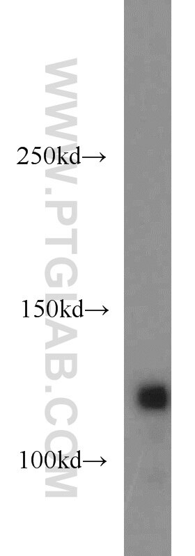 Western Blot (WB) analysis of mouse brain tissue using LUZP1 Polyclonal antibody (17483-1-AP)