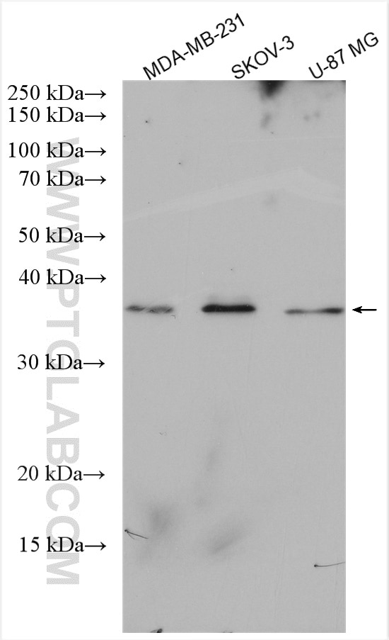 Western Blot (WB) analysis of various lysates using LUZP4 Polyclonal antibody (11072-1-AP)