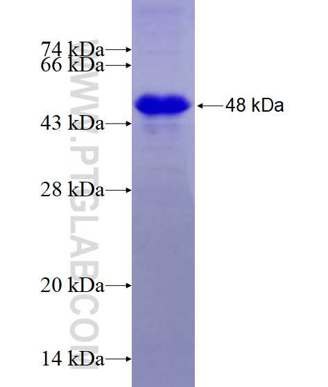 LUZP4 fusion protein Ag1539 SDS-PAGE