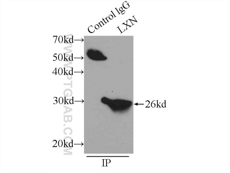 Immunoprecipitation (IP) experiment of mouse lung tissue using LXN Polyclonal antibody (13056-1-AP)