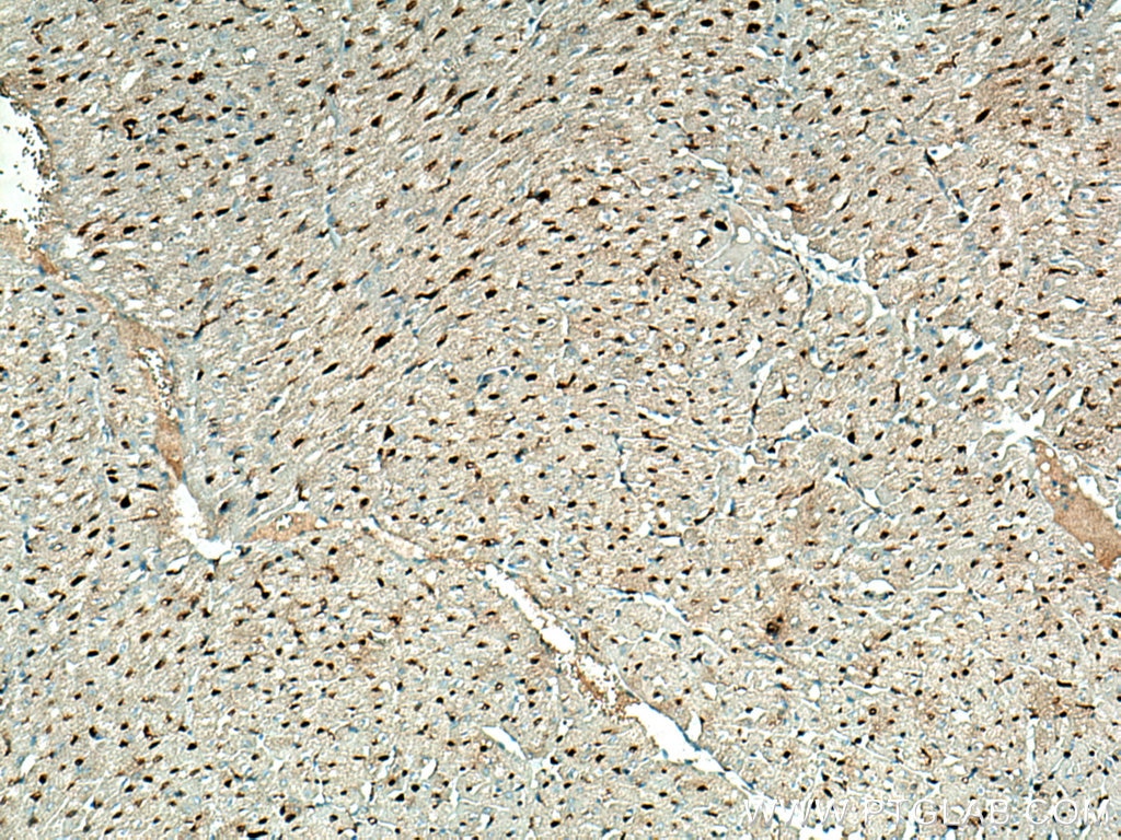 Immunohistochemistry (IHC) staining of human heart tissue using LXN Monoclonal antibody (66957-1-Ig)