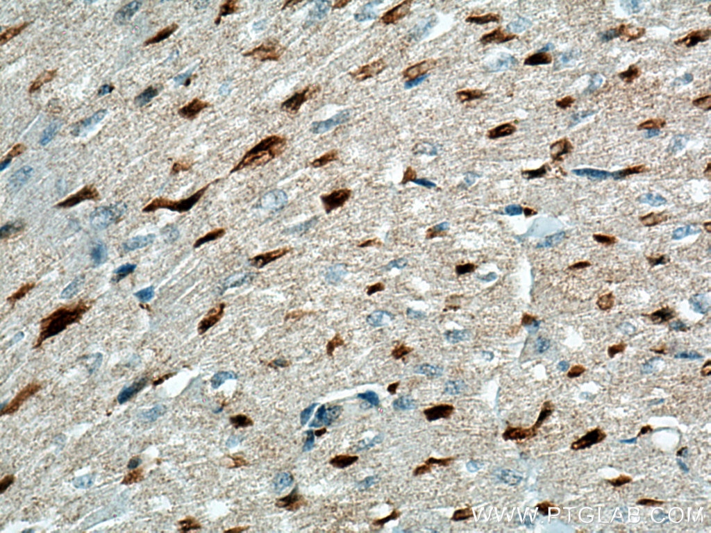 IHC staining of human heart using 66957-1-Ig