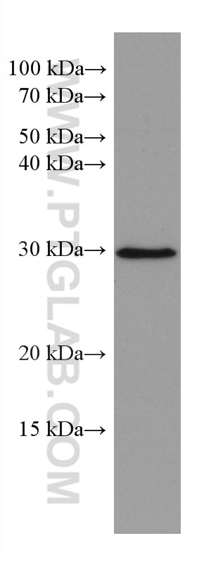 WB analysis of SH-SY5Y using 66957-1-Ig