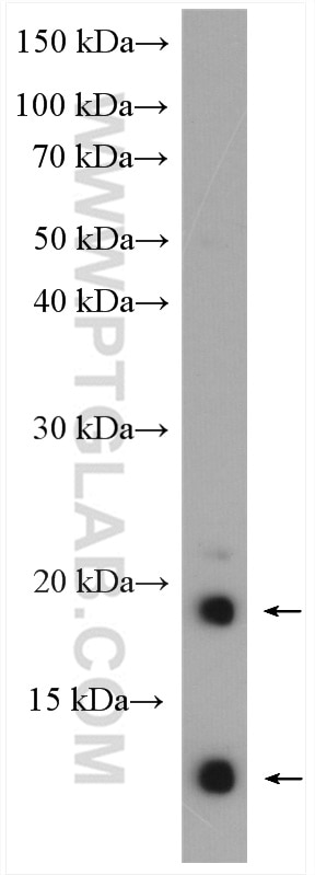 Western Blot (WB) analysis of mouse kidney tissue using LY6E Polyclonal antibody (22144-1-AP)