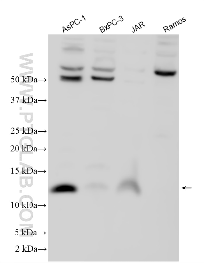 Western Blot (WB) analysis of various lysates using LY6E Polyclonal antibody (22144-1-AP)