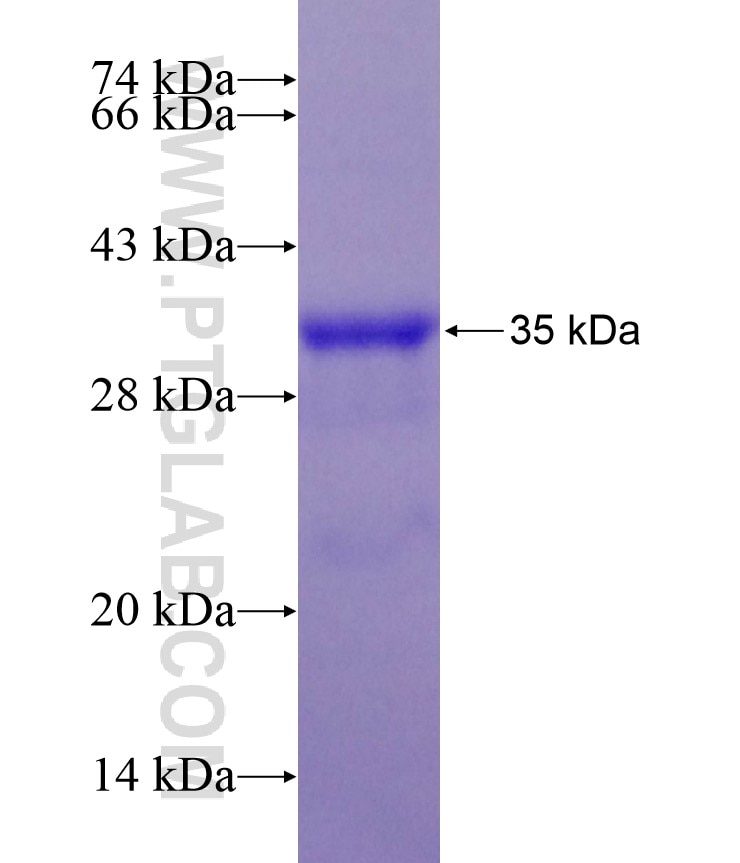 LY6E fusion protein Ag17573 SDS-PAGE